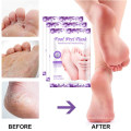 OEM 2 Paar Peeling am besten effektiv abgestorbene Haut entfernen Fußmaske
